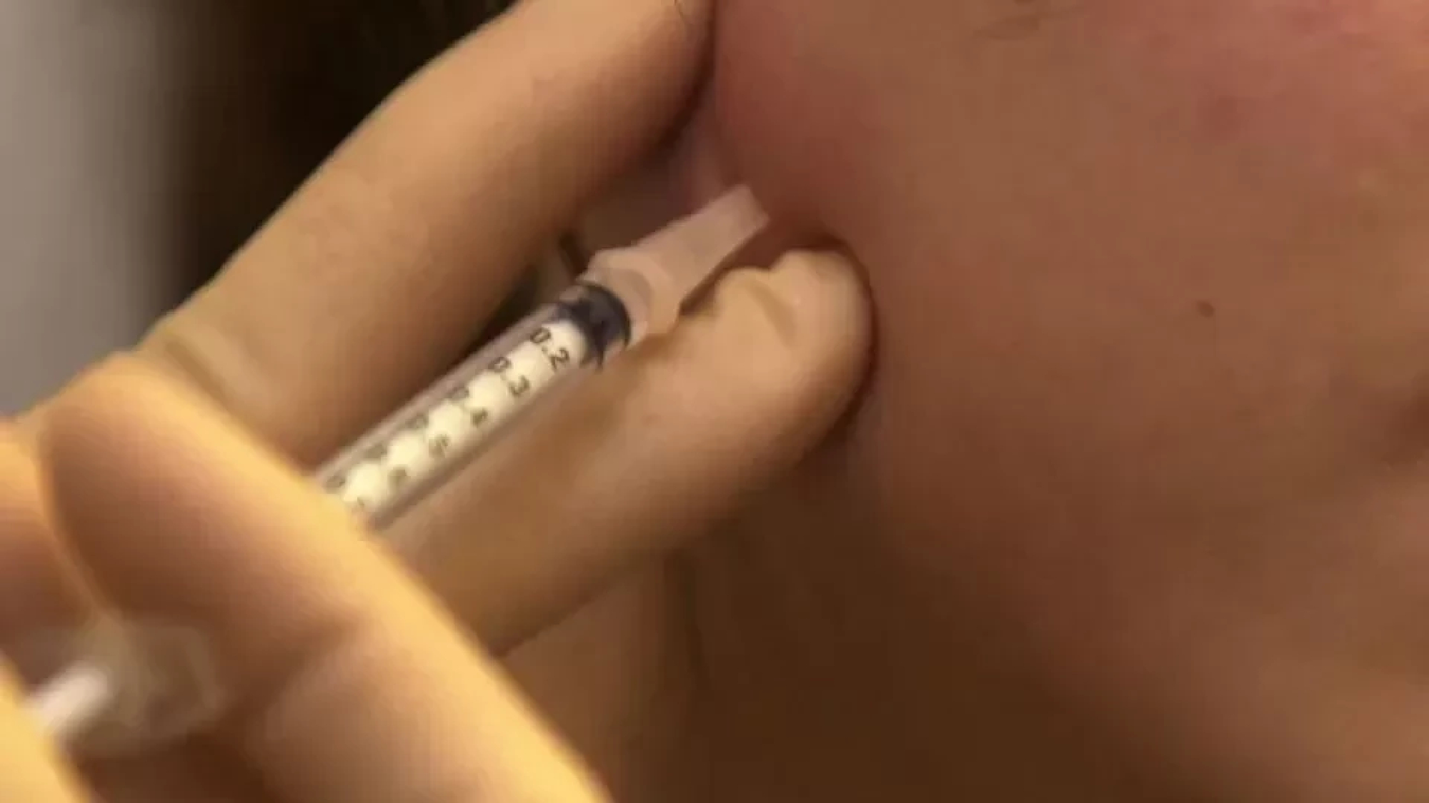 Looks to die for: Unmasking Malaysia’s beauty quacks