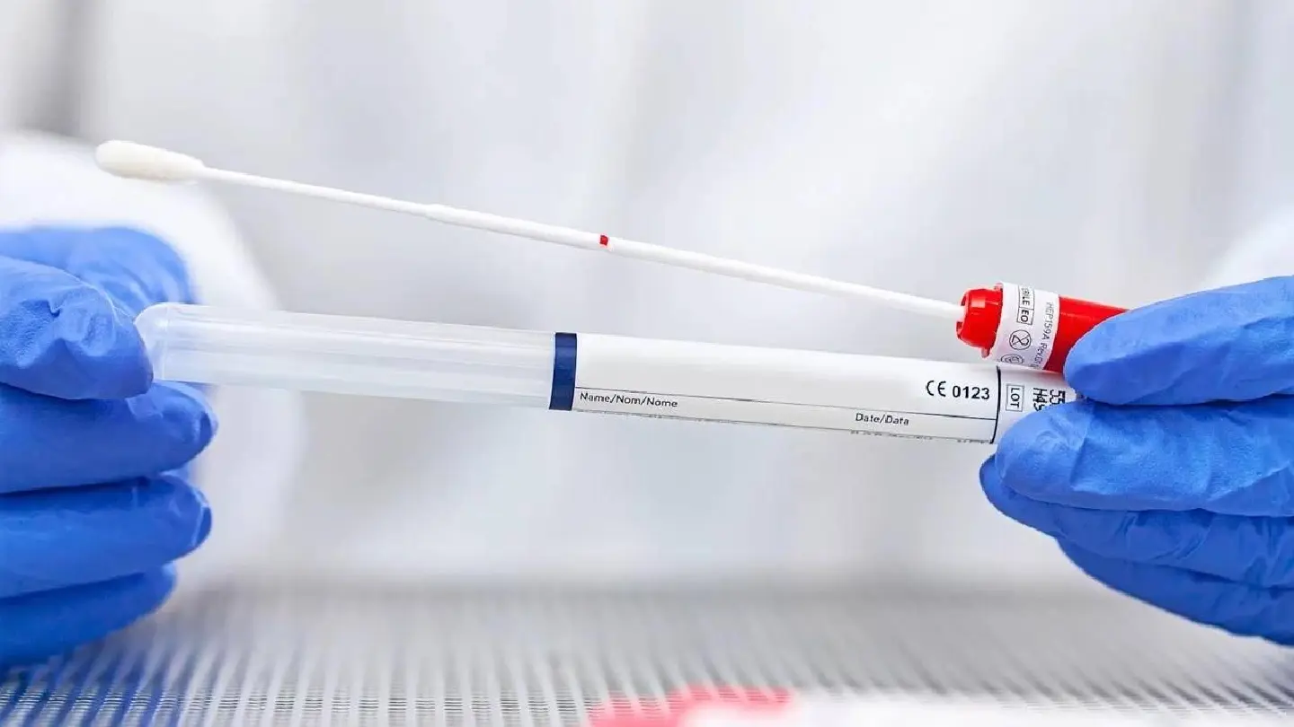 Doctors unveil self-testing kits to screen for cervical cancer Doctors unveil self-testing kits to screen for cervical cancer