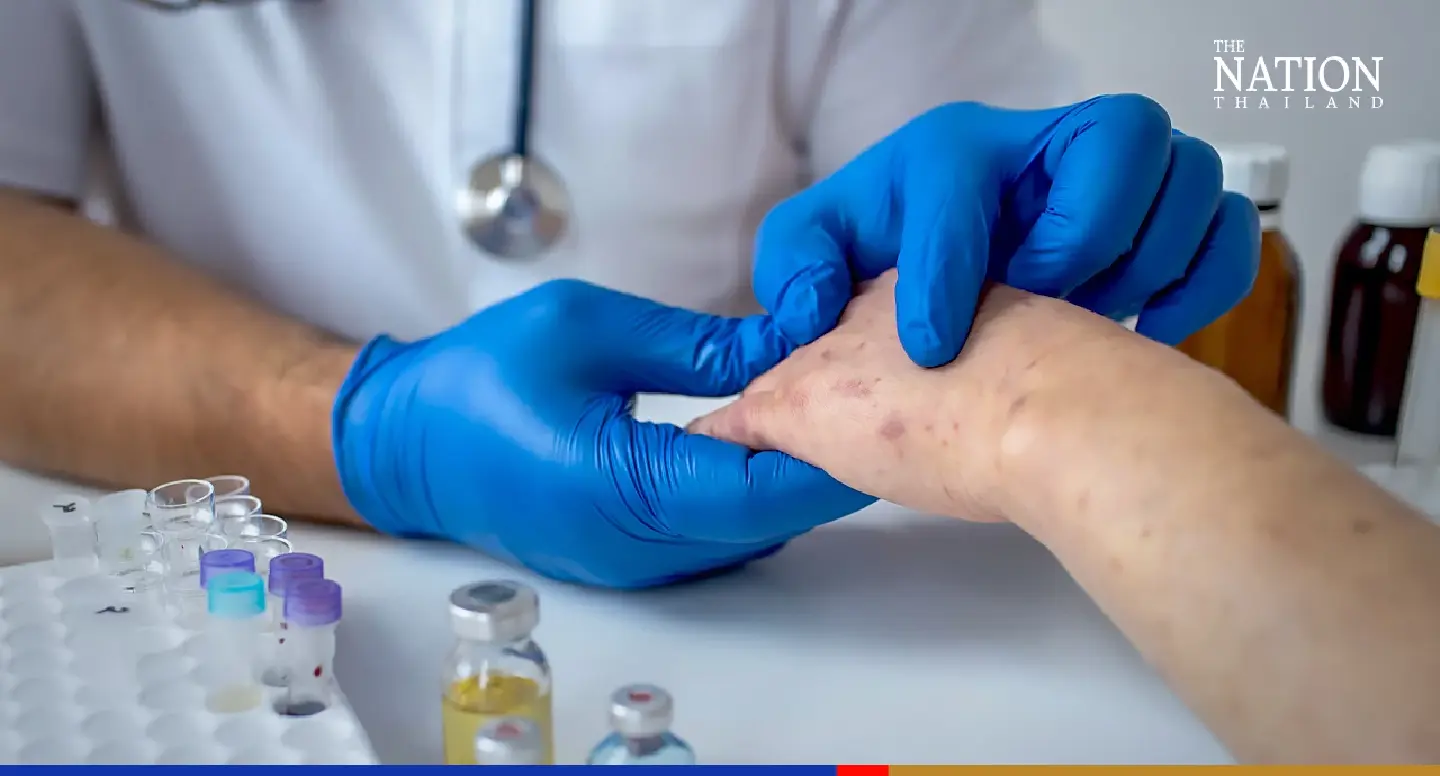 Siriraj faculty researchers up the ante in battle against neglected tropical diseases like dengue Siriraj faculty researchers up the ante in battle against neglected tropical diseases like dengue