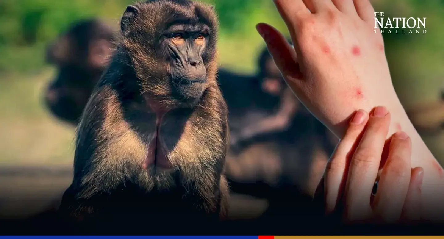 Masseur confirmed as Thailand’s 11th monkeypox case after returning from Qatar