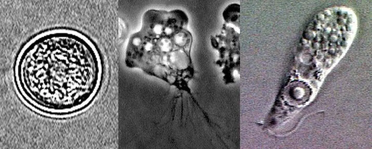 Korean dies from 'brain-eating amoeba' after returning from Thailand