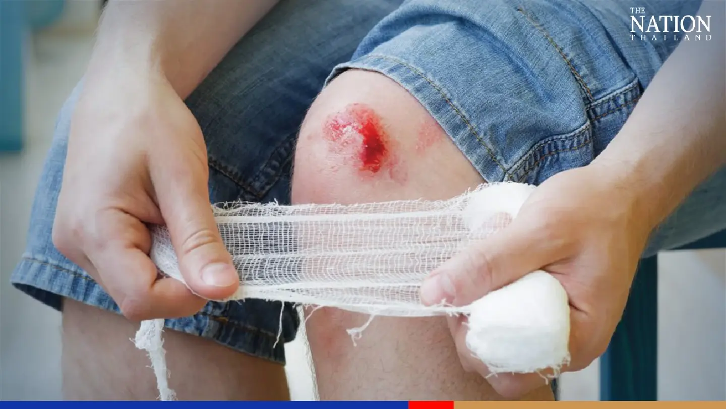 “Haemophilia” – a Disease that May Not Be Cured But Opportunities for a Good Life Are Still Possible “Haemophilia” – a Disease that May Not Be Cured But Opportunities for a Good Life Are Still Possible