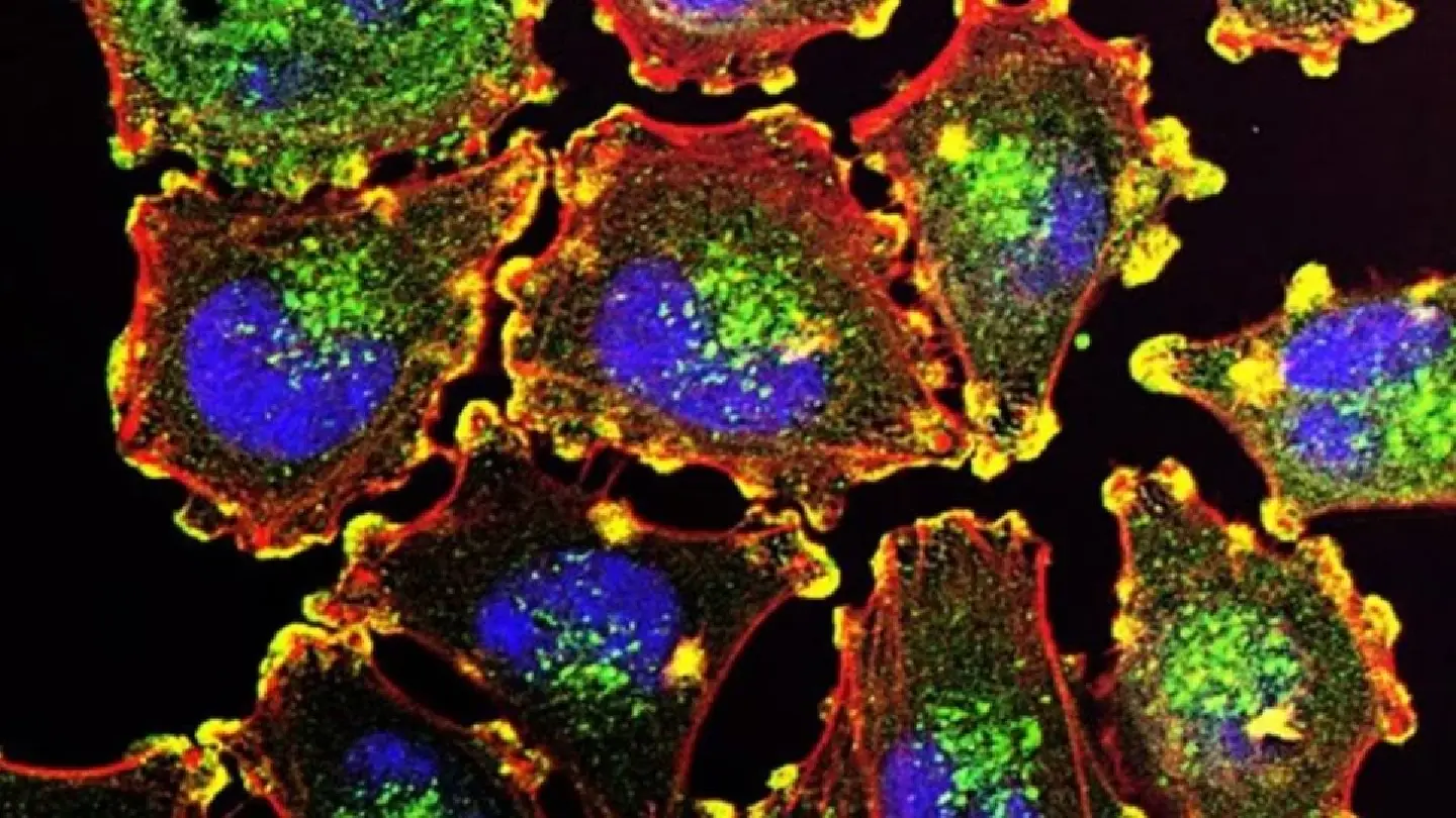 Artificial intelligence developed to identify cancer mutations