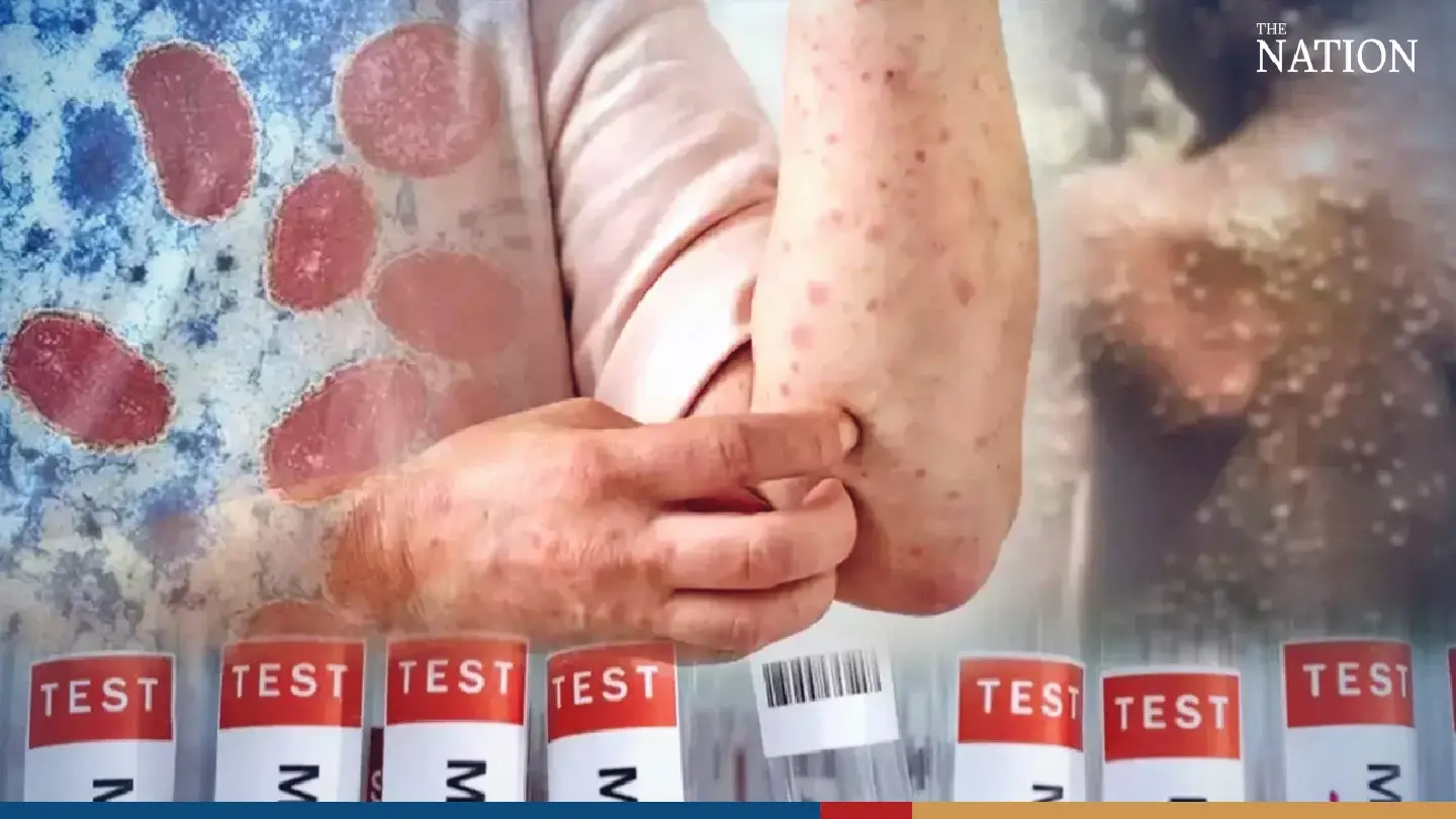 Gay men warned to practice safe sex as Mpox infections found in 19 provinces among men
