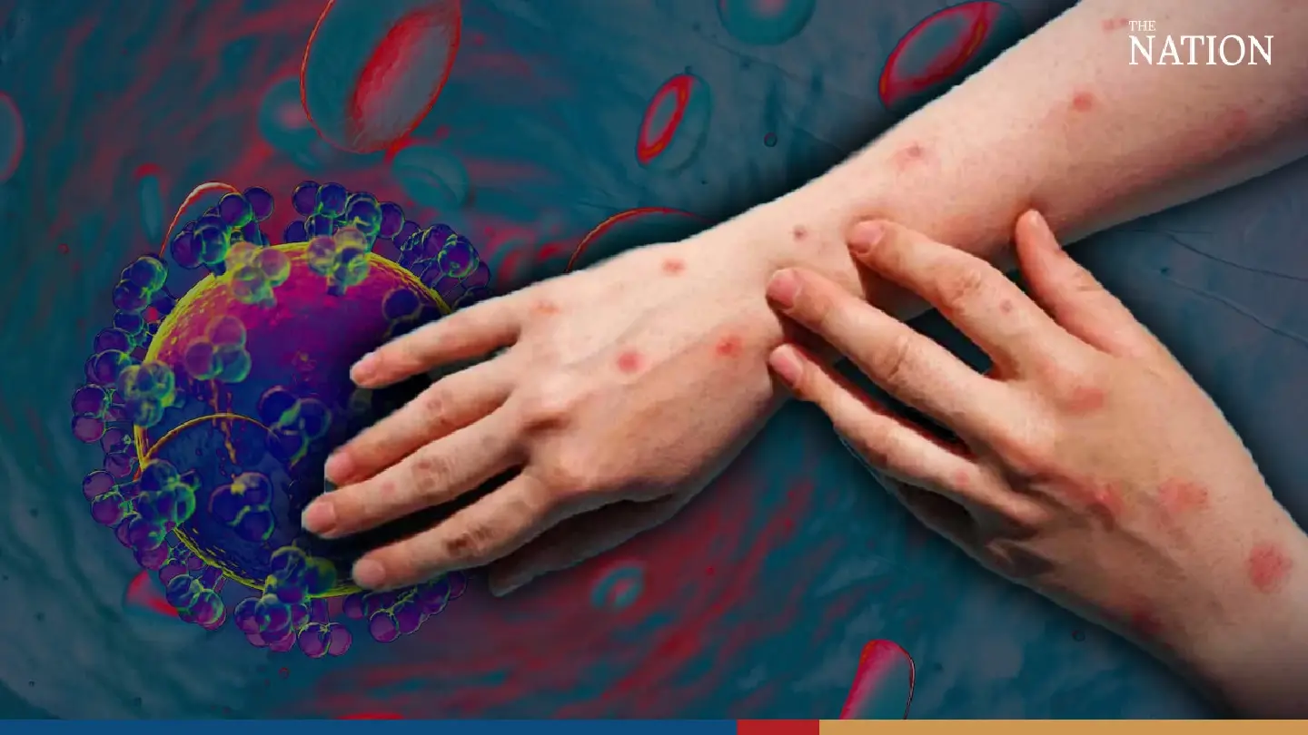 Man, 36, becomes first patient to die of Mpox in Thailand