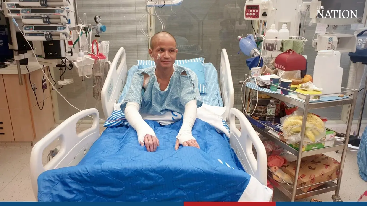 Thai worker, recovering from 50% burns, recounts the deadly Hamas attack Thai worker, recovering from 50% burns, recounts the deadly Hamas attack