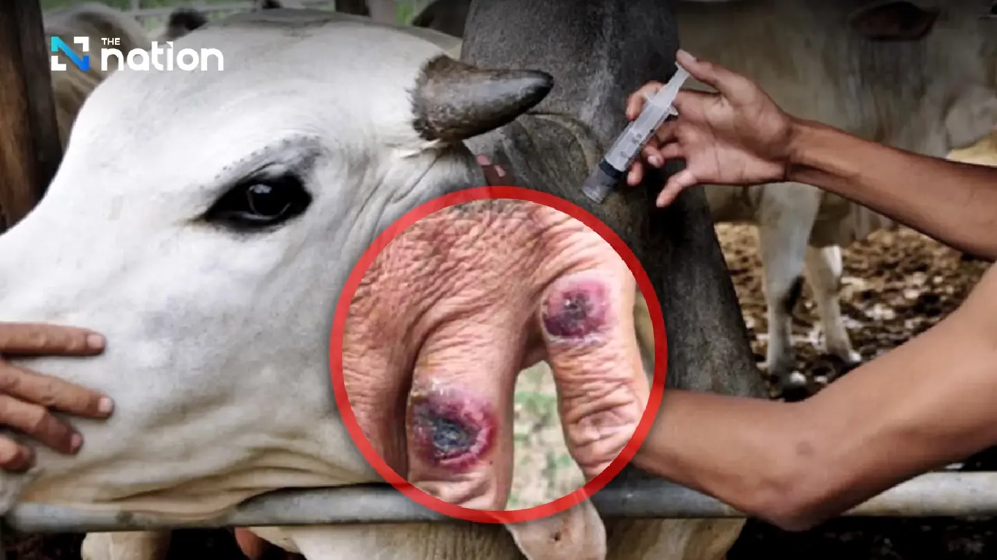 Anthrax outbreak affects 54 in Laos, Thailand on high alert Anthrax outbreak affects 54 in Laos, Thailand on high alert