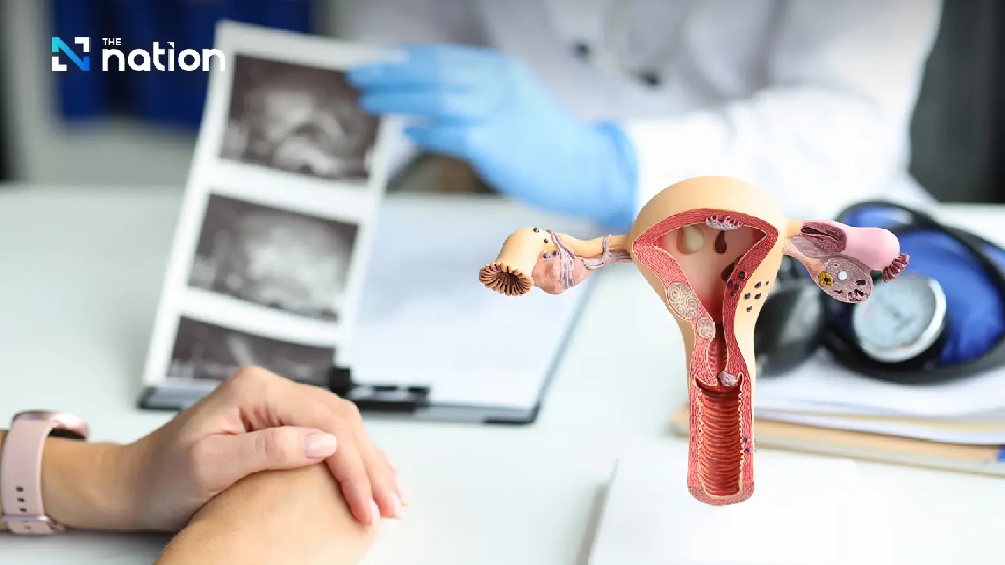 Thailand offers free self-tests amid 15 daily cervical cancer cases