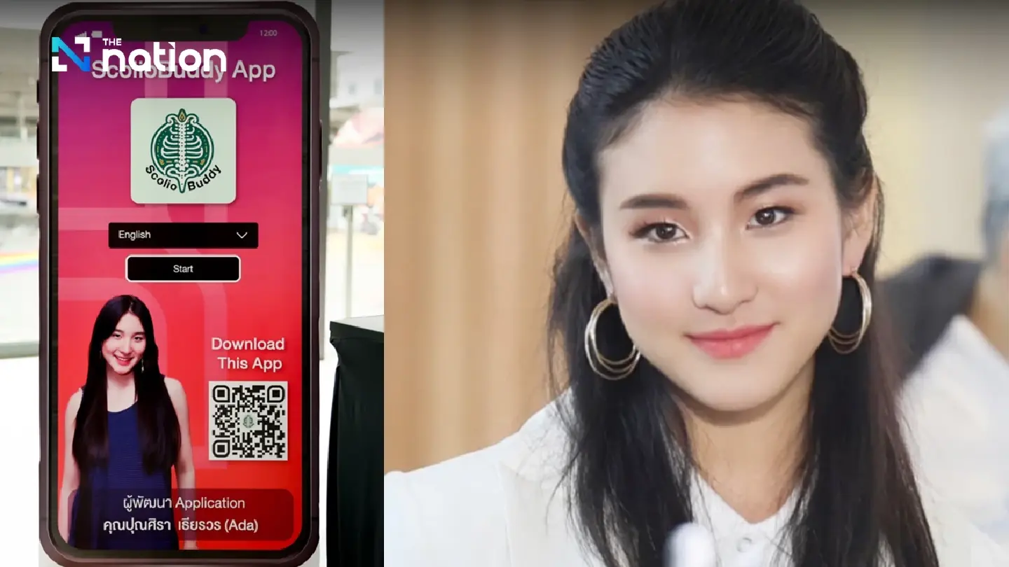 Revolutionizing scoliosis care: Launch of the free ScolioBuddy App Revolutionizing scoliosis care: Launch of the free ScolioBuddy App