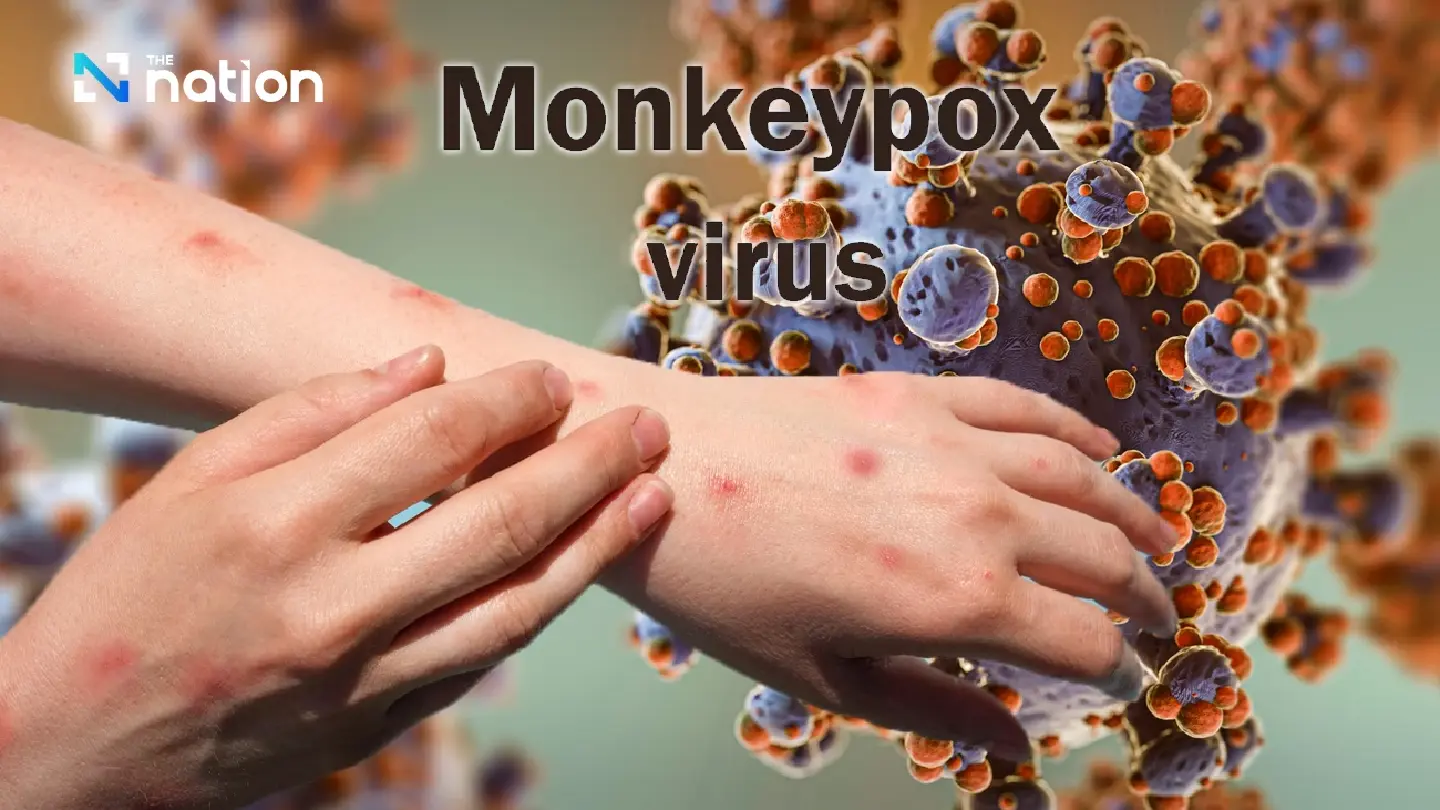 Thai hotels urge strict mpox screening amid tourism, economy concerns