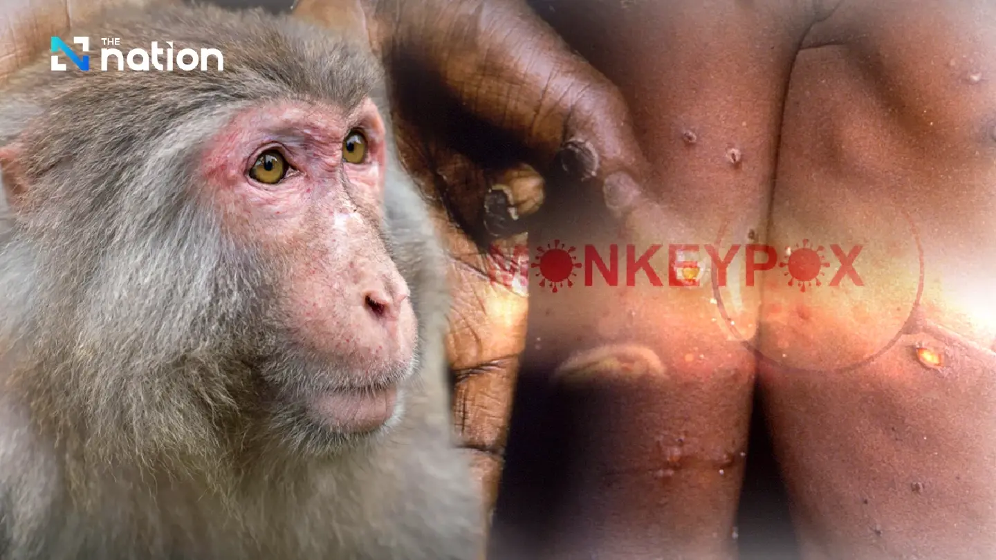 First case of mpox clade 1b detected in Thailand