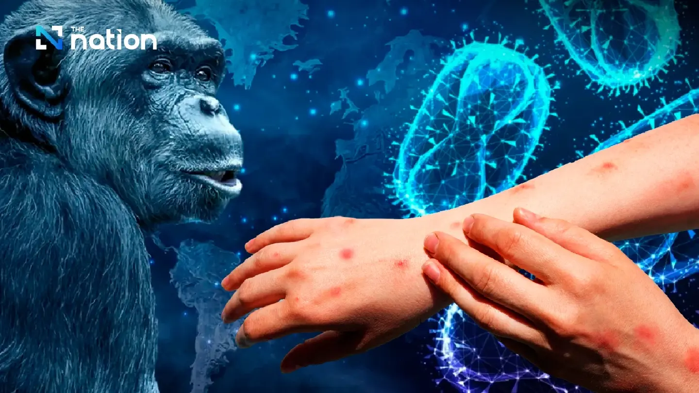 Mpox in Thailand different from African strain: Health authorities