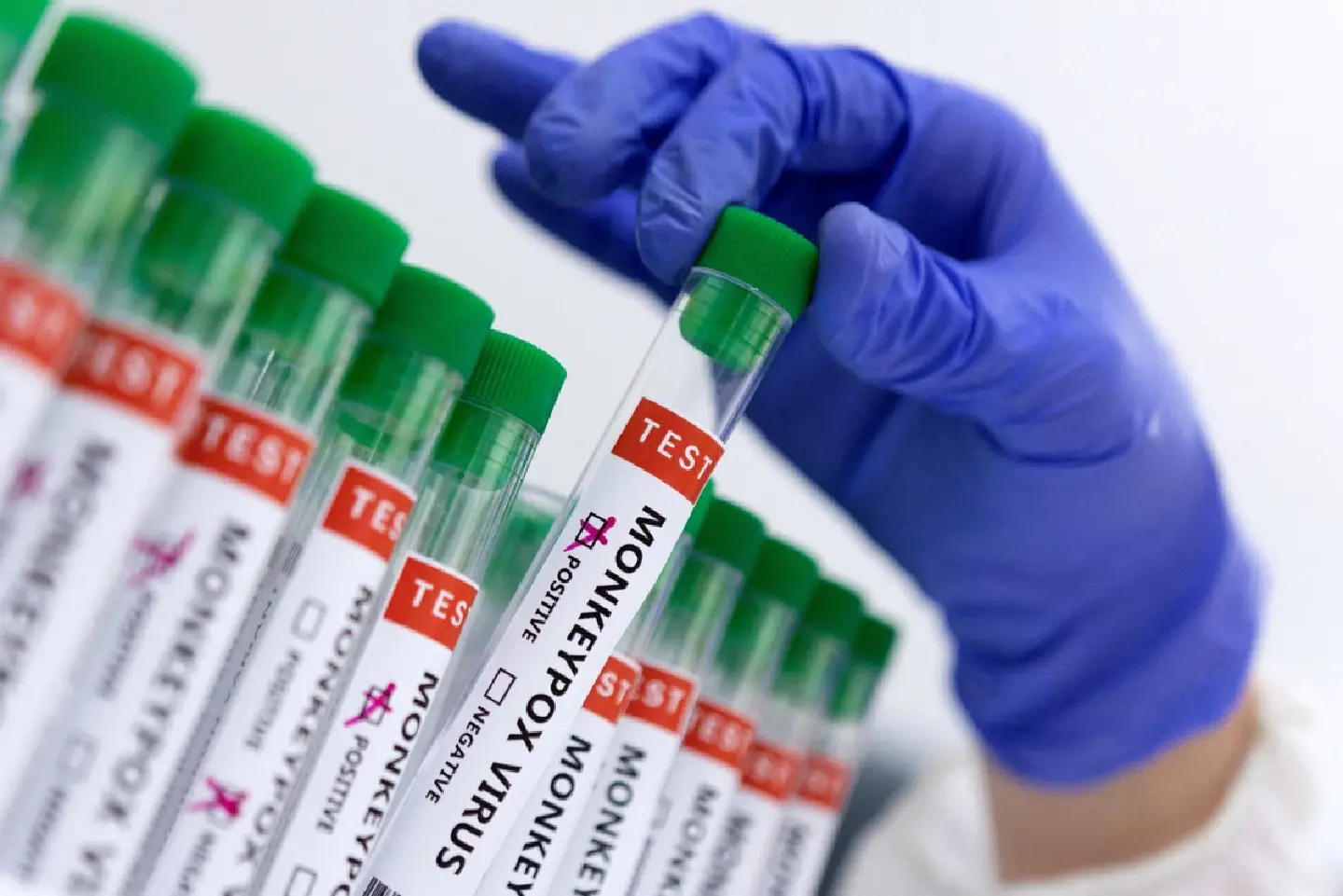 Chinese mpox vaccine gets green light for clinical trials Chinese mpox vaccine gets green light for clinical trials