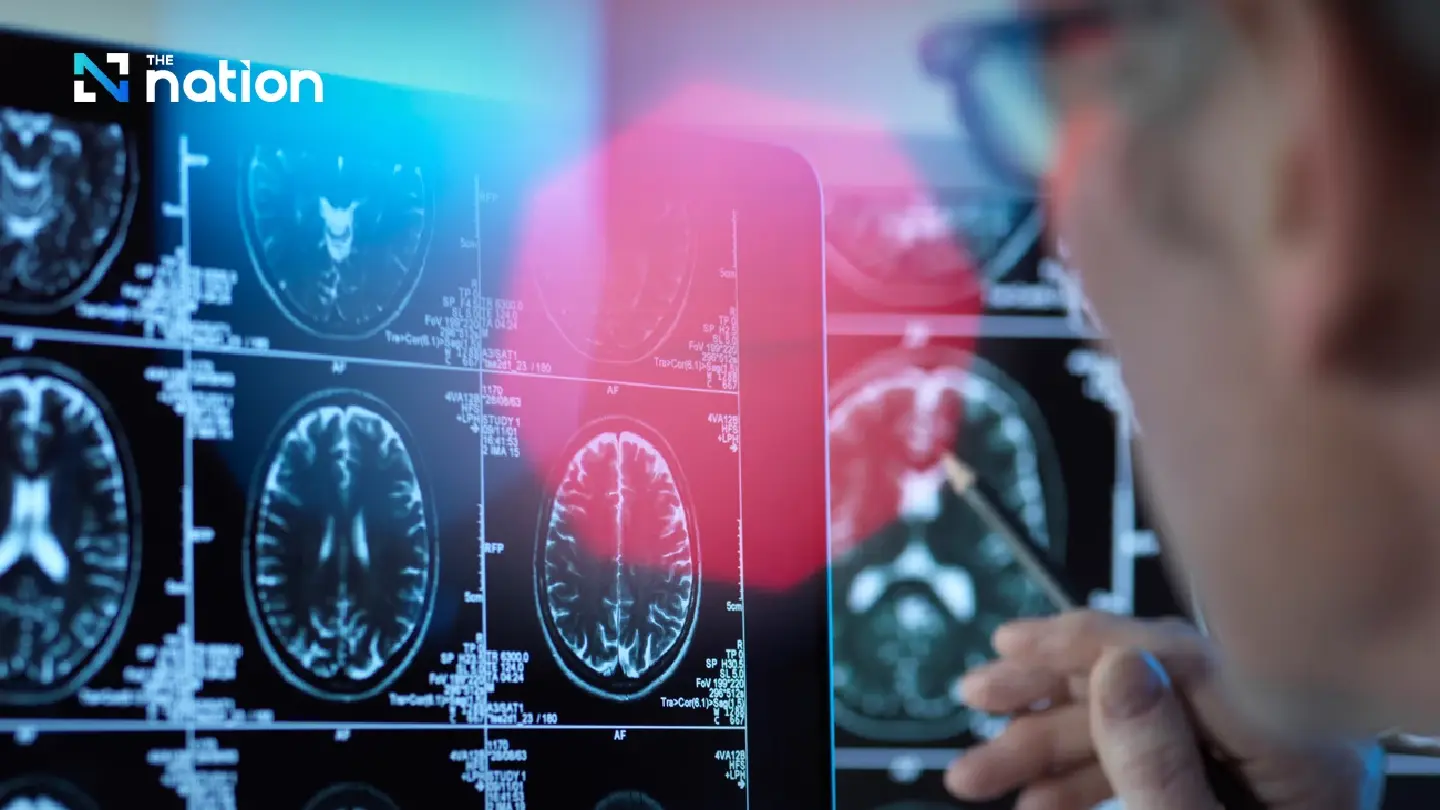 Why preventive care and early diagnosis of Alzheimer’s are important
