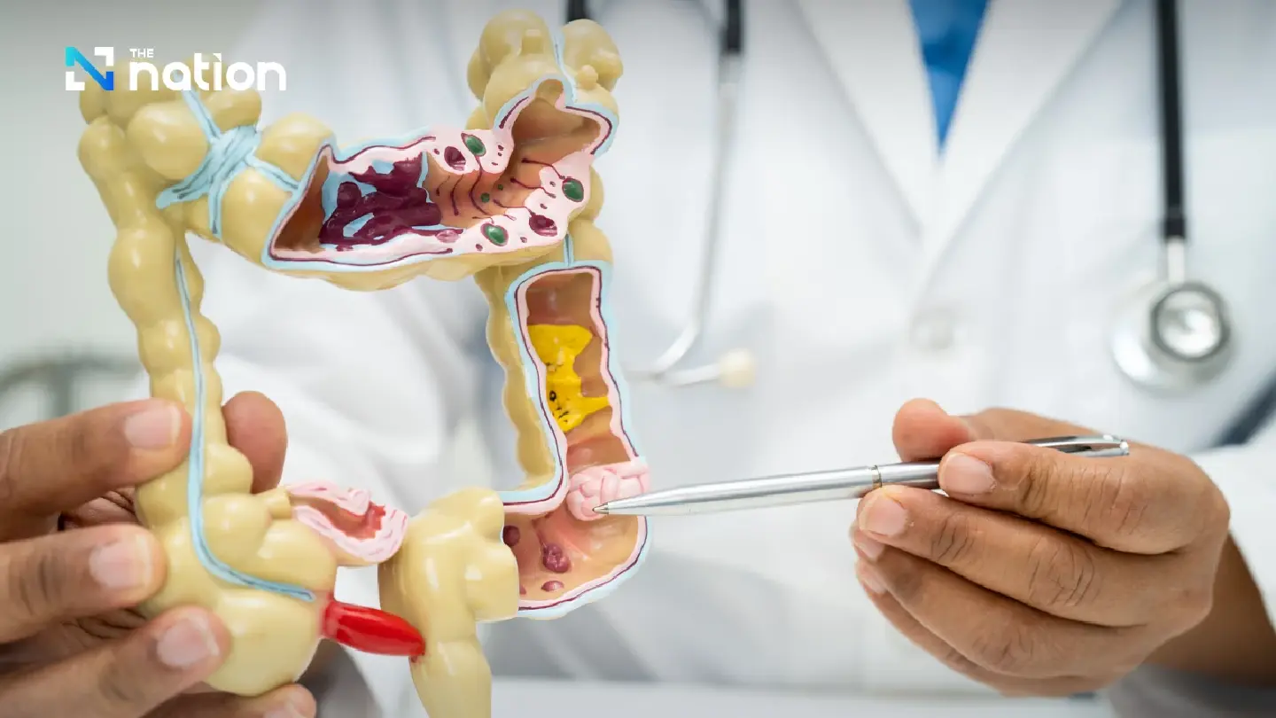 Technologies and approaches developed to tackle colorectal cancer Technologies and approaches developed to tackle colorectal cancer