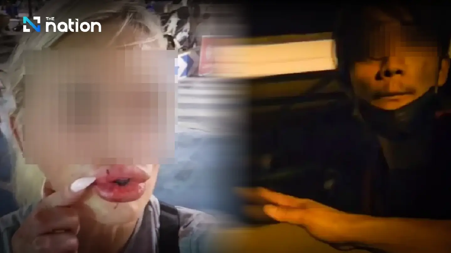 Russian woman assaulted in Pattaya at night by Bolt rider Russian woman assaulted in Pattaya at night by Bolt rider