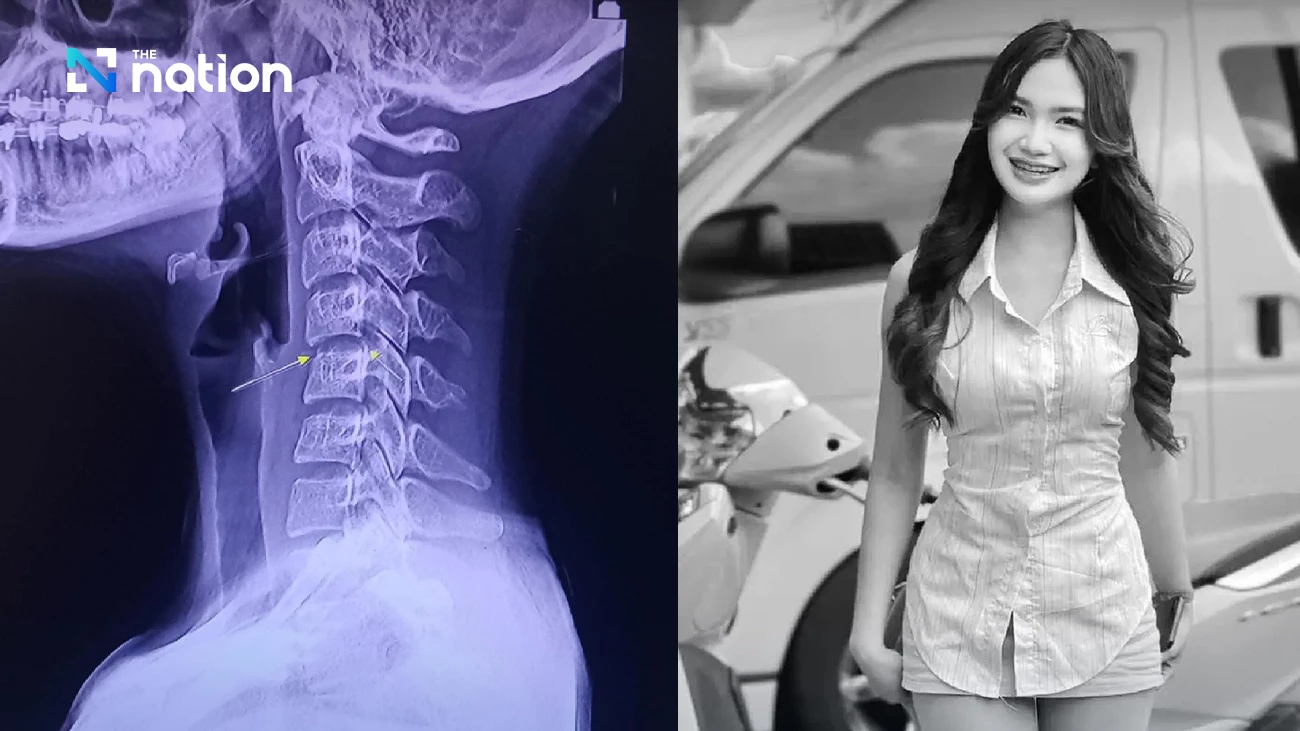 Warnings issued as woman dies after neck-twisting massage