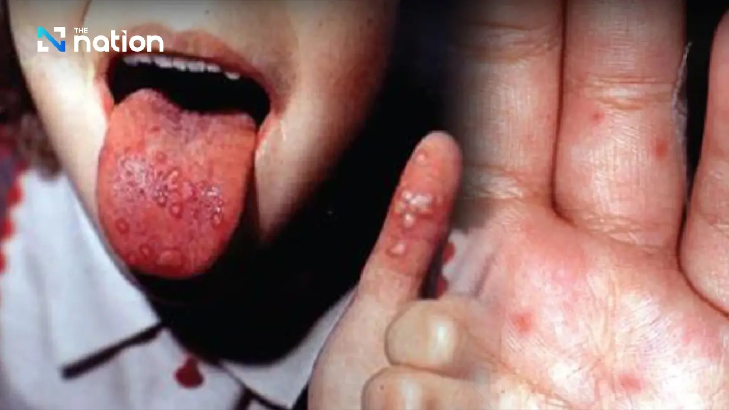 Why Diana, 3, succumbed to enterovirus infection Why Diana, 3, succumbed to enterovirus infection