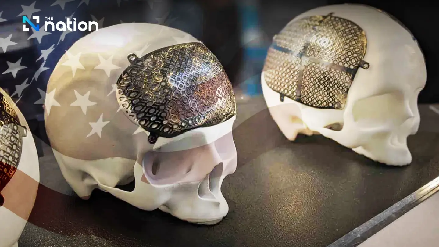 Titanium cranioplasty plate made in Thailand used in successful operation in US