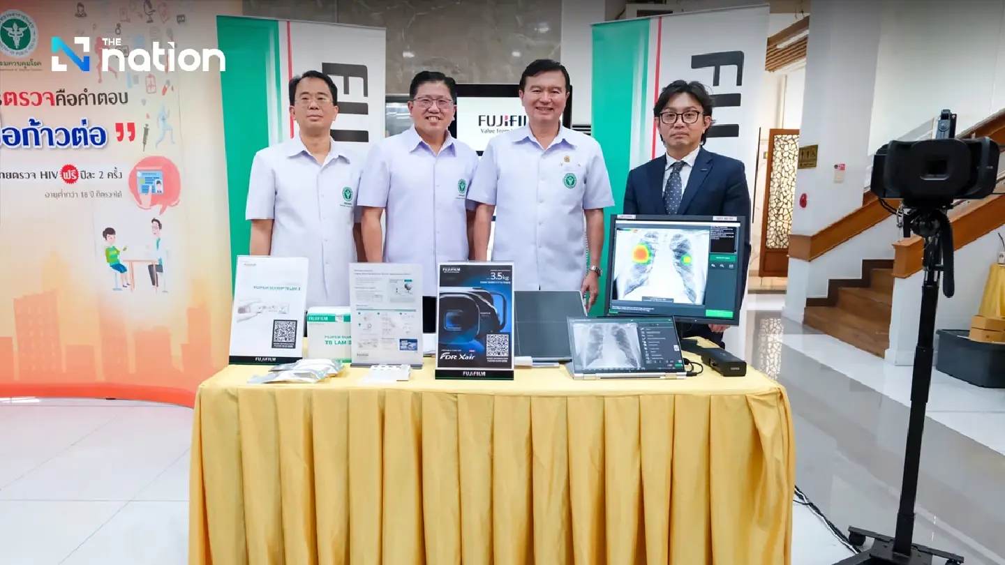 FUJIFILM Promotes TB Screening Among People Living with HIV FUJIFILM Promotes TB Screening Among People Living with HIV
