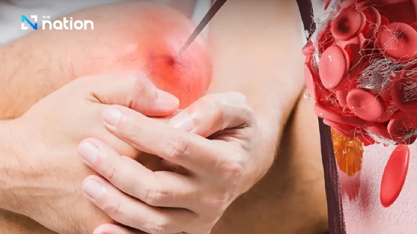 Flesh-eating disease: What to know about the deadly bacterial infection Flesh-eating disease: What to know about the deadly bacterial infection