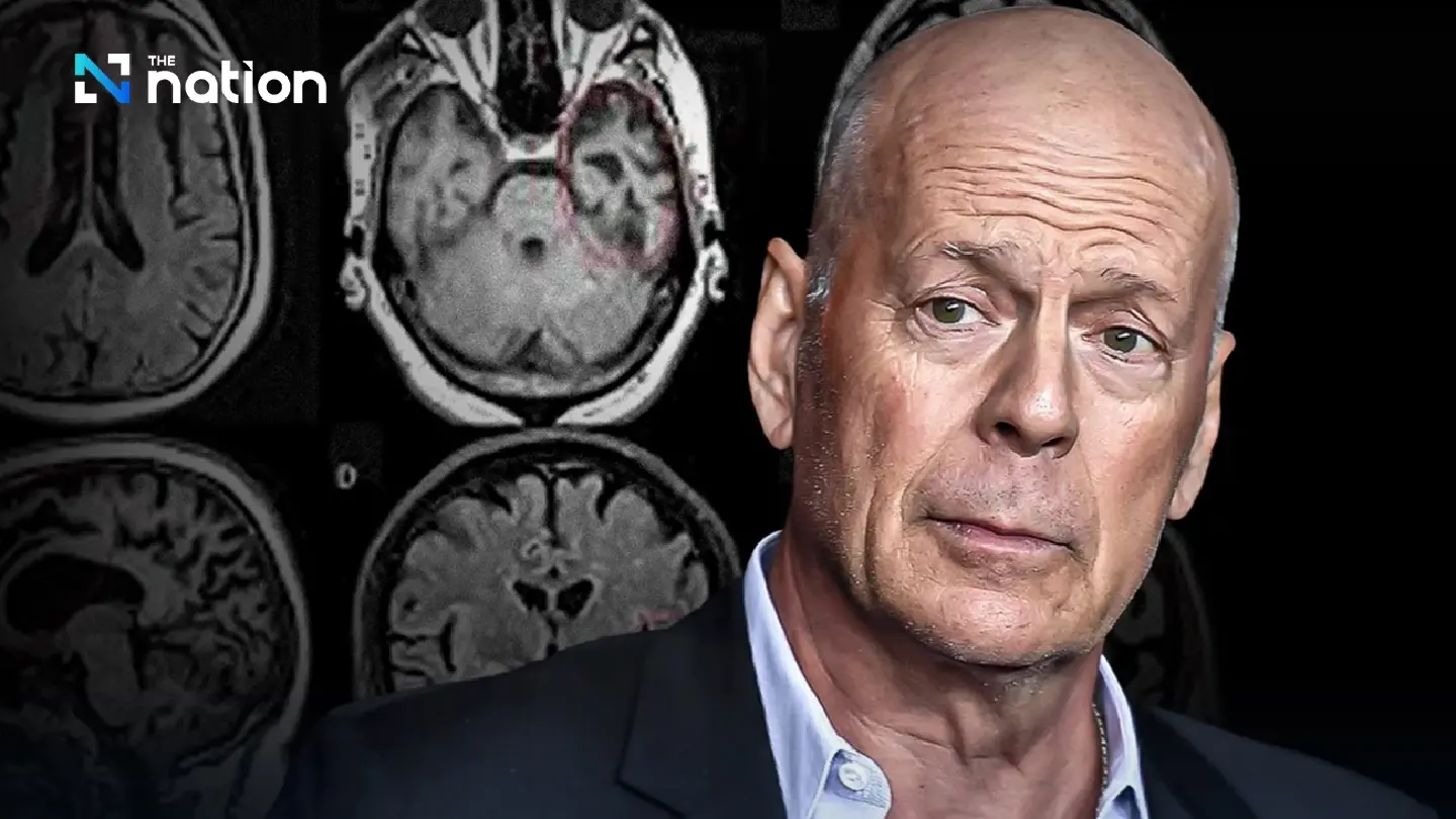 FTD: The silent brain disease impacting Bruce Willis' quality of life