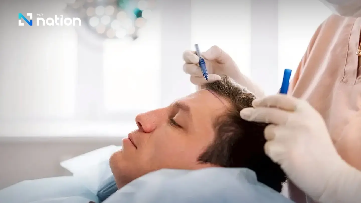 Thailand Aims to Become Global Hair Transplant Hub Thailand Aims to Become Global Hair Transplant Hub