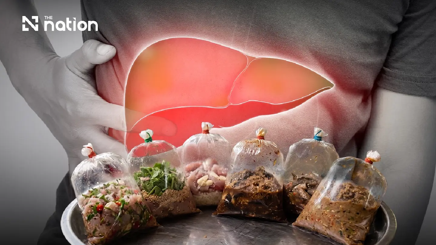Thailand raw fish dishes linked to liver fluke and bile duct cancer risk Thailand raw fish dishes linked to liver fluke and bile duct cancer risk