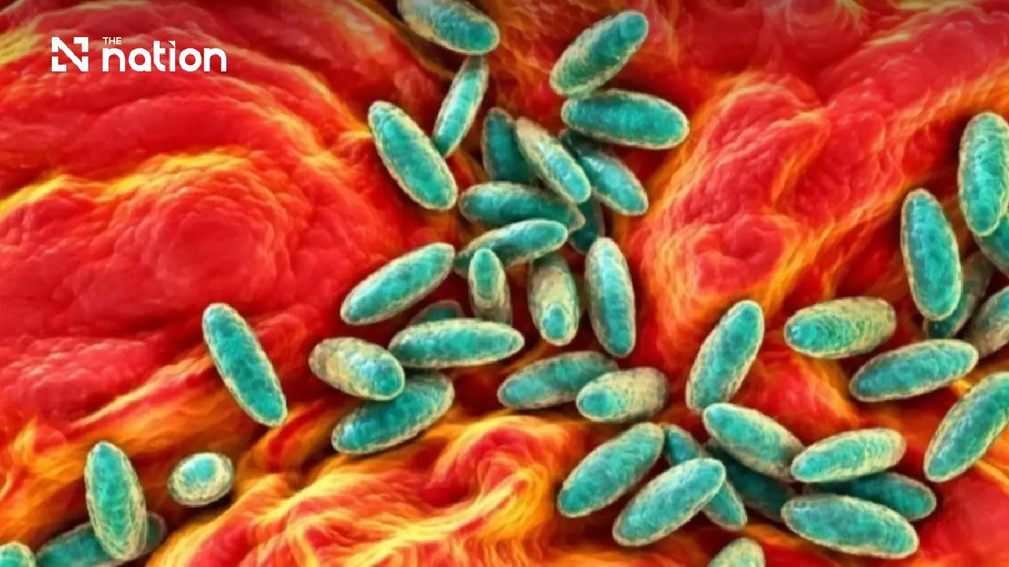 Immigration plans separate lanes over reports of pneumonic plague in Russia Immigration plans separate lanes over reports of pneumonic plague in Russia